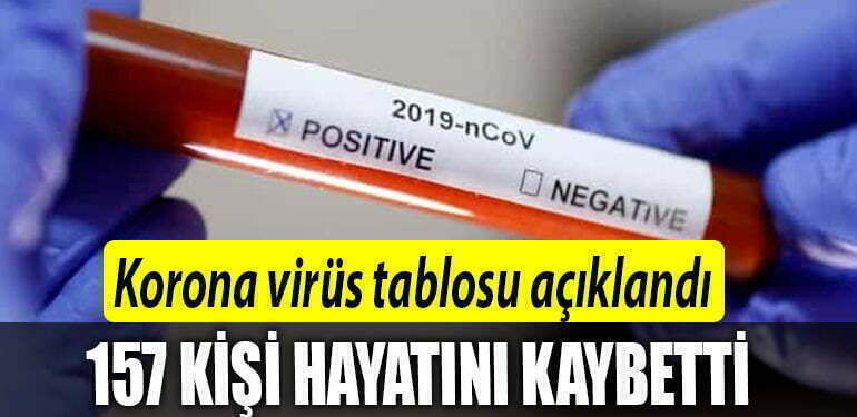 korona kaç kişi öldü