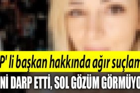 sol gozum gormuyor