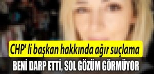 sol gozum gormuyor