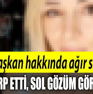 sol gozum gormuyor