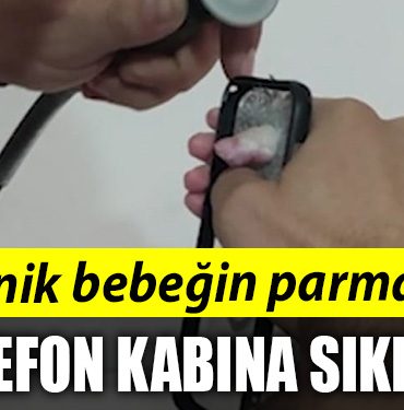 MINIK BEBEGIN PARMAGI SIKISTI