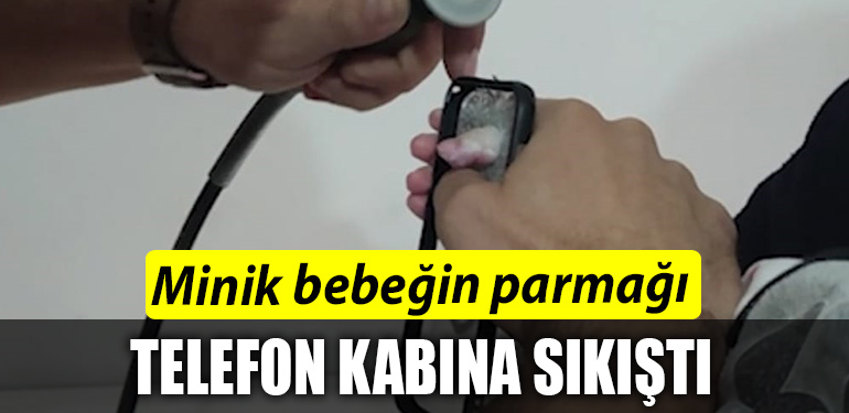 MINIK BEBEGIN PARMAGI SIKISTI