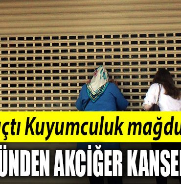 Gulacti Kuyumculuk magduru Onun yuzunden akciger kanseri oldum