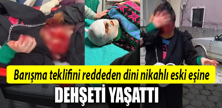 sakarya dehset
