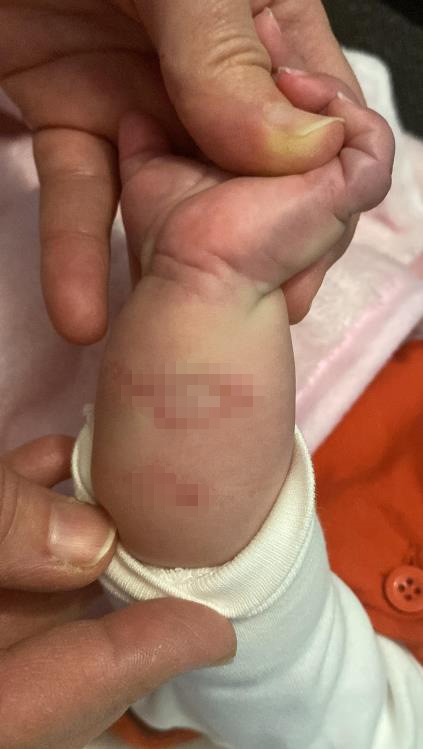 SAĞLIKLI DÖRDÜZ BEBEK DÜNYAYA GETİREN ANNEYE ÜÇ CESET VERDİLER HASTANEDE DOĞAN DÖRDÜZ BEBEKLER İDDİAYA GÖRE KUVÖZDE YANDI, MİKROP KAPARAK ÜÇÜ ÖLDÜ EN MUTLU GÜNLERİ ACIYLA BİTTİ, DÖRDÜZ BEBEKLERİNDEN SADECE BİRİNİ KUCAĞINA ALDILAR