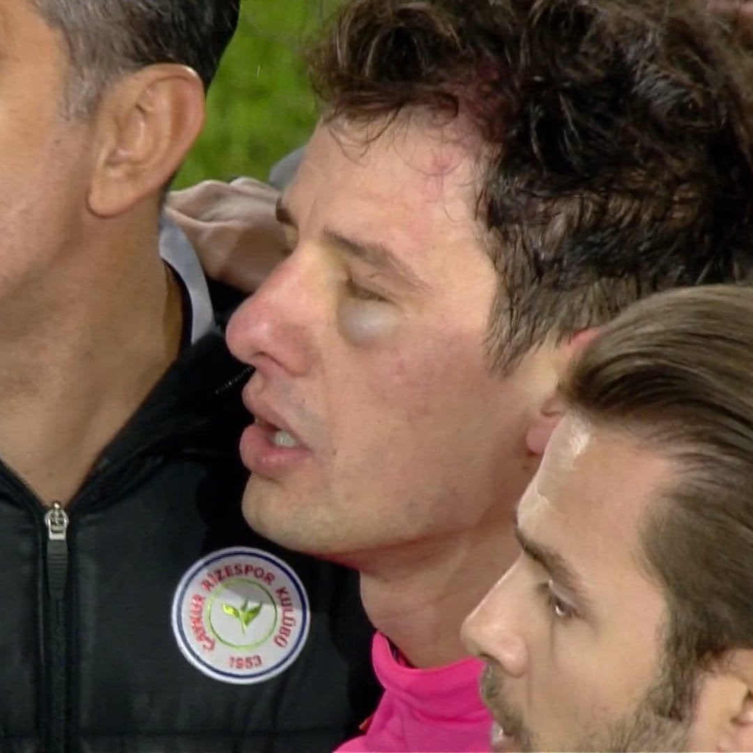 O Başkan sahaya girdi ve hakemi yumrukladı