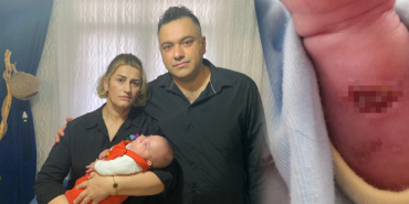 aile bebek yanık