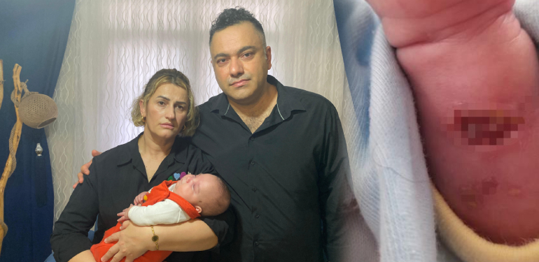 aile bebek yanık
