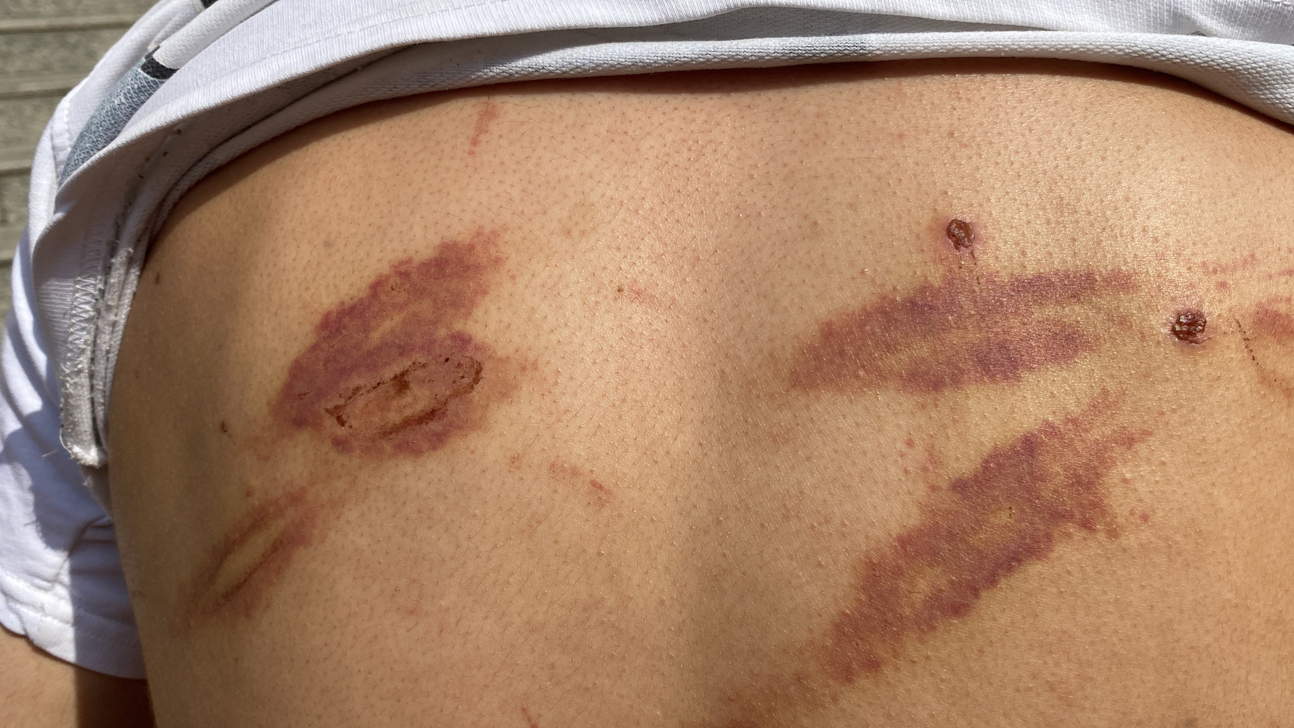 ÖLDÜRESİYE DARP EDİLMİŞTİ, YAŞADIKLARINI ANLATTI AKILLARA DURGUNLUK VEREN OLAYIN TARAFLARI KONUŞTU