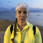 DENİZDE YÜZERKEN JET SKİ ÇARPTI, ÖLÜMDEN DÖNDÜ "SUYUN İÇİNE GİRDİĞİMDE GÖZLERİM AÇIK, ETRAFIM KAN İÇİNDEYDİ"