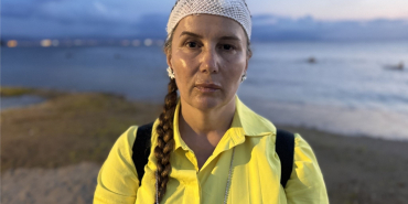 DENİZDE YÜZERKEN JET SKİ ÇARPTI, ÖLÜMDEN DÖNDÜ "SUYUN İÇİNE GİRDİĞİMDE GÖZLERİM AÇIK, ETRAFIM KAN İÇİNDEYDİ"
