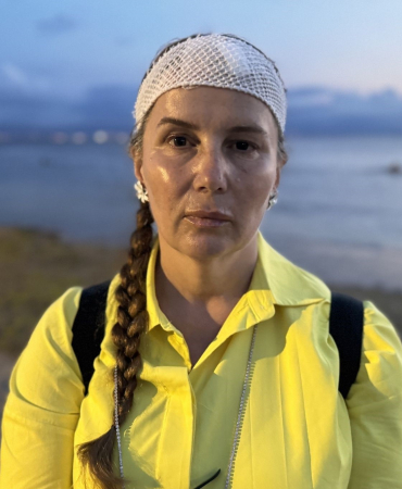 DENİZDE YÜZERKEN JET SKİ ÇARPTI, ÖLÜMDEN DÖNDÜ "SUYUN İÇİNE GİRDİĞİMDE GÖZLERİM AÇIK, ETRAFIM KAN İÇİNDEYDİ"