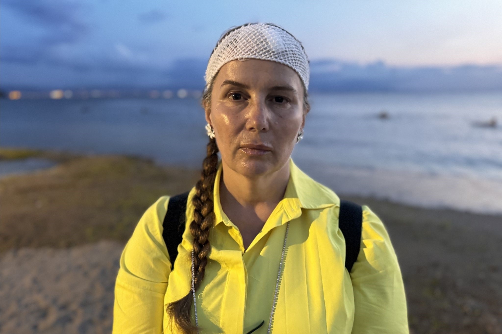 DENİZDE YÜZERKEN JET SKİ ÇARPTI, ÖLÜMDEN DÖNDÜ "SUYUN İÇİNE GİRDİĞİMDE GÖZLERİM AÇIK, ETRAFIM KAN İÇİNDEYDİ"