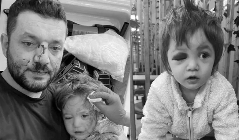 Baba ve 14 Aylık Bebeğe Saldırıda Kan Donduran İfadeler! Bebeği Görmedik Savunması Şok Etti