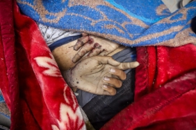 Lancet-Gazze8217deki-Gercek-Can-Kaybi-Aciklanandan-Cok-Daha-Fazla-featured