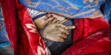 Lancet-Gazze8217deki-Gercek-Can-Kaybi-Aciklanandan-Cok-Daha-Fazla-featured