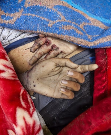 Lancet-Gazze8217deki-Gercek-Can-Kaybi-Aciklanandan-Cok-Daha-Fazla-featured