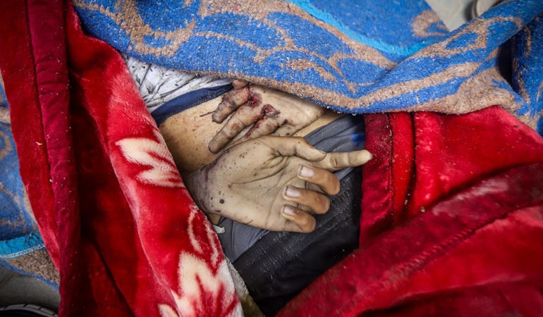 Lancet-Gazze8217deki-Gercek-Can-Kaybi-Aciklanandan-Cok-Daha-Fazla-featured