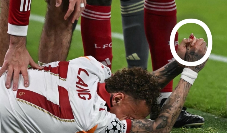 Liverpool maçında Noa Lang’ın parmağı koptu